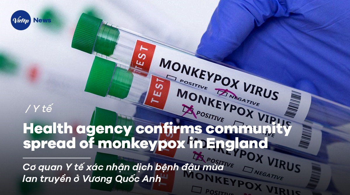 Health agency confirms community spread of monkeypox in England